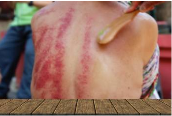 Più pressione è migliore in Gua Sha?